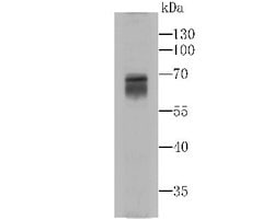 MAO-A Mouse anti-Human, Clone: 5D1, Novus Biologicals 100 &mu;l; Unconjugated:Antibodies,